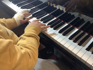 骨折 保谷ピアノ教室